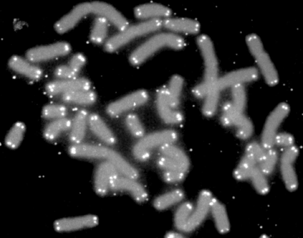 Telomeres are the ends of a chromosome that protect cells against degradation. According to researchers if we can work out a way to preserve telomeres, then we would be another step closer to defeating aging. Dr Aziz Aboobaker from Nottingham University's School of Biology, said: "Usually when stem cells divide -- to heal wounds, or during reproduction or for growth -- they start to show signs of aging. This means that the stem cells are no longer able to divide and so become less able to replace exhausted specialized cells in the tissues of our bodies. Our aging skin is perhaps the most visible example of this effect."