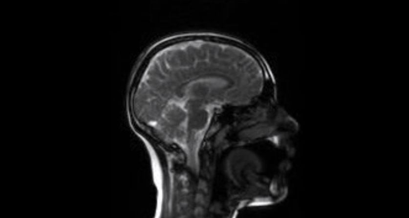 They then played the recordings of real and posed laughter to people while scanning their brains with fMRI. "When people heard the posed laughter, there was more activation in brain areas associated with metalizing tasks -- ie. trying to work out what someone else is thinking," said Scott.