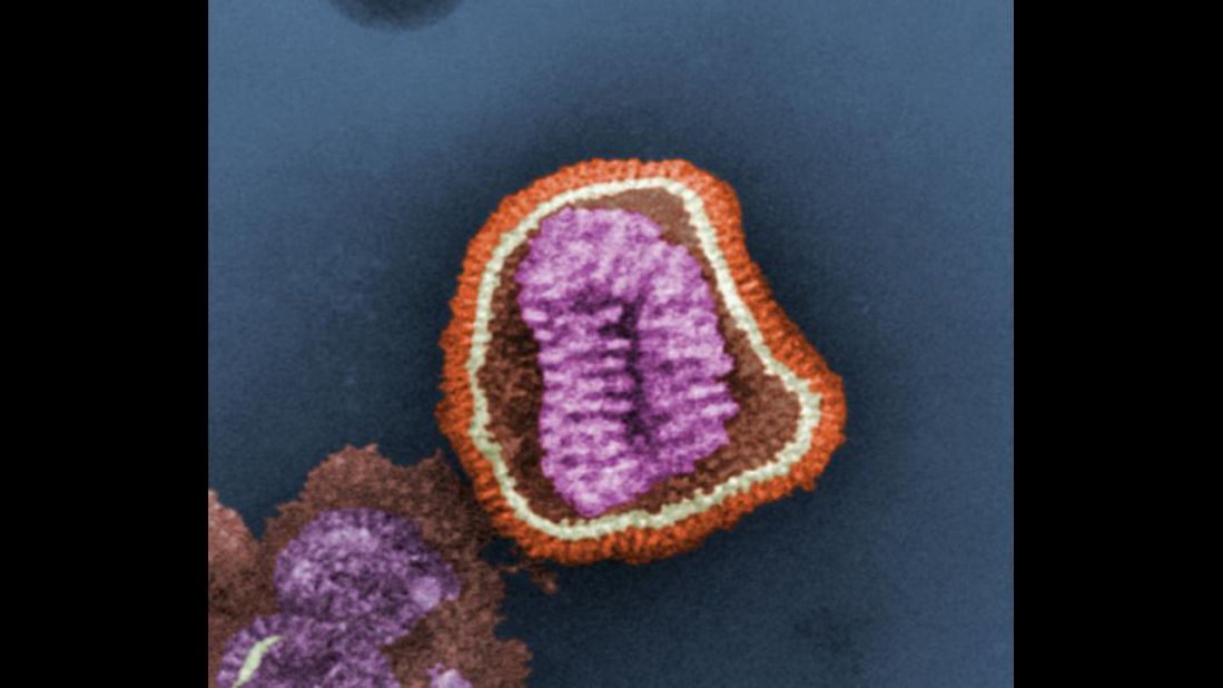 This is an influenza virus particle, also known as a virion, according to the Centers for Disease Control and Prevention. Virions are made up of an outer protein shell and an inner core of nucleic acid: in this case, eight single-stranded RNA segments. 