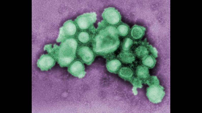 H1N1 was called "swine flu" because it was similar to the virus seen in pigs, as this photo illustrates. The WHO officially called an end to the H1N1 pandemic in August 2010, but cases with the strain still appear each year. "It is likely that the 2009 H1N1 virus will continue to spread for years to come, like a regular seasonal influenza virus," <a href="index.php?page=&url=http%3A%2F%2Fwww.cdc.gov%2Fh1n1flu%2F" target="_blank" target="_blank">the CDC says</a>.
