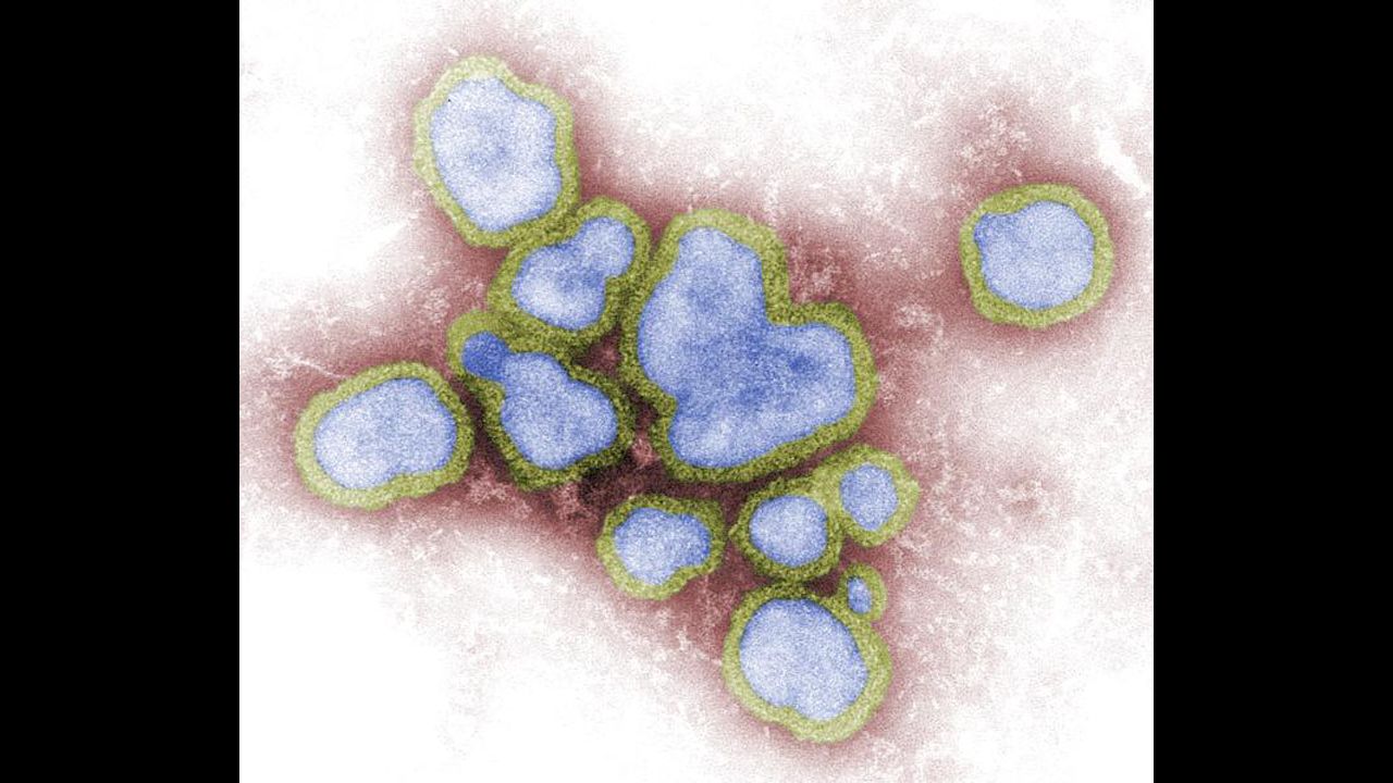 This image depicts a number of influenza A virions. There are three basic types of influenza viruses -- A, B and C -- but only influenza A can infect animals, such as pigs or birds. When a virus strain enters an animal, it may change, causing a more serious epidemic when it returns to humans. 