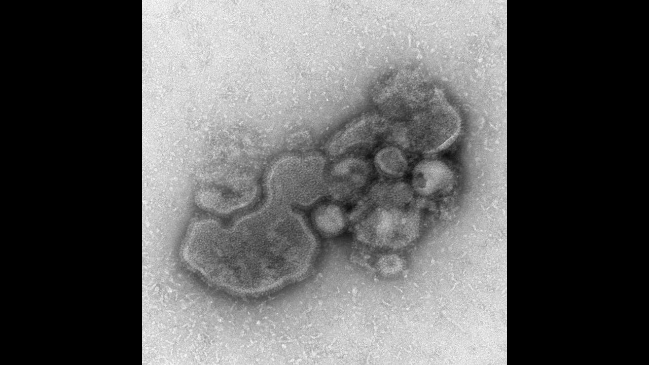 virus under microscope