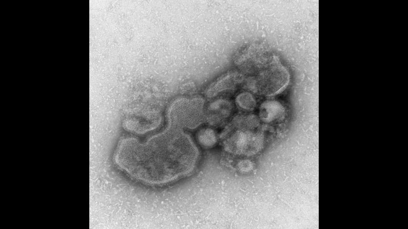 In China in 2013, <a href="http://www.cdc.gov/flu/avianflu/h7n9-virus.htm" target="_blank" target="_blank">H7N9</a>, or avian influenza A, was seen in poultry and in people who worked closely with poultry. In 2016, a number of provinces in China have shut down live poultry markets to prevent the spread of avian flu.