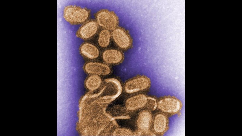 In 1997, scientists took lung tissue from five 1918 Spanish flu victims and extracted the nucleic acid to sequence the flu strain's genome. This image shows the re-created influenza virions that caused the outbreak, infecting close to a fifth of the world's population and <a href="index.php?page=&url=http%3A%2F%2Fwww.flu.gov%2Fpandemic%2Fhistory%2F1918%2Fthe_pandemic%2Findex.html" target="_blank" target="_blank">killing an estimated 30 million to 50 million</a> people in less than a year, according to the US Department of Health and Human Services.