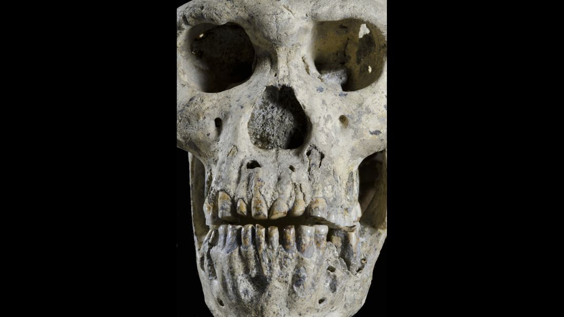 This skull, known as Skull 5, was matched to a jaw -- pictured here -- that was found several years earlier. 