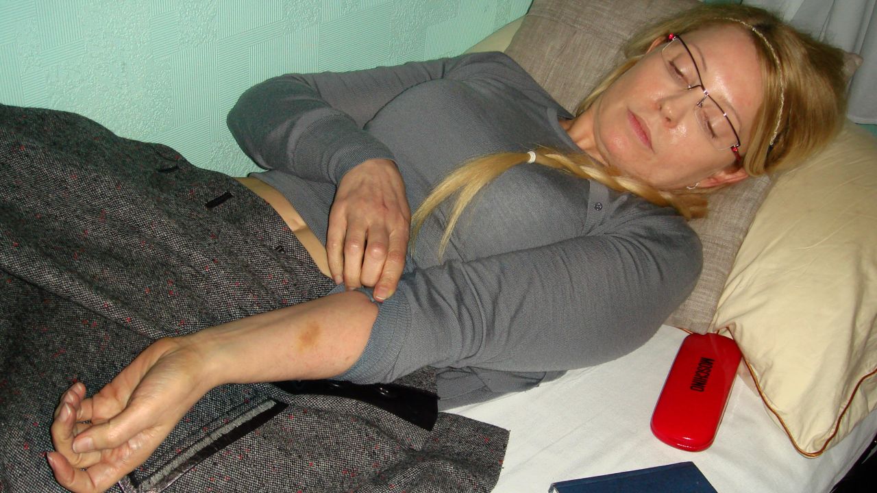 A picture taken on April 25, 2012, shows Yulia Tymoshenko in the Kachanivska penitentiary colony in Kharkiv.