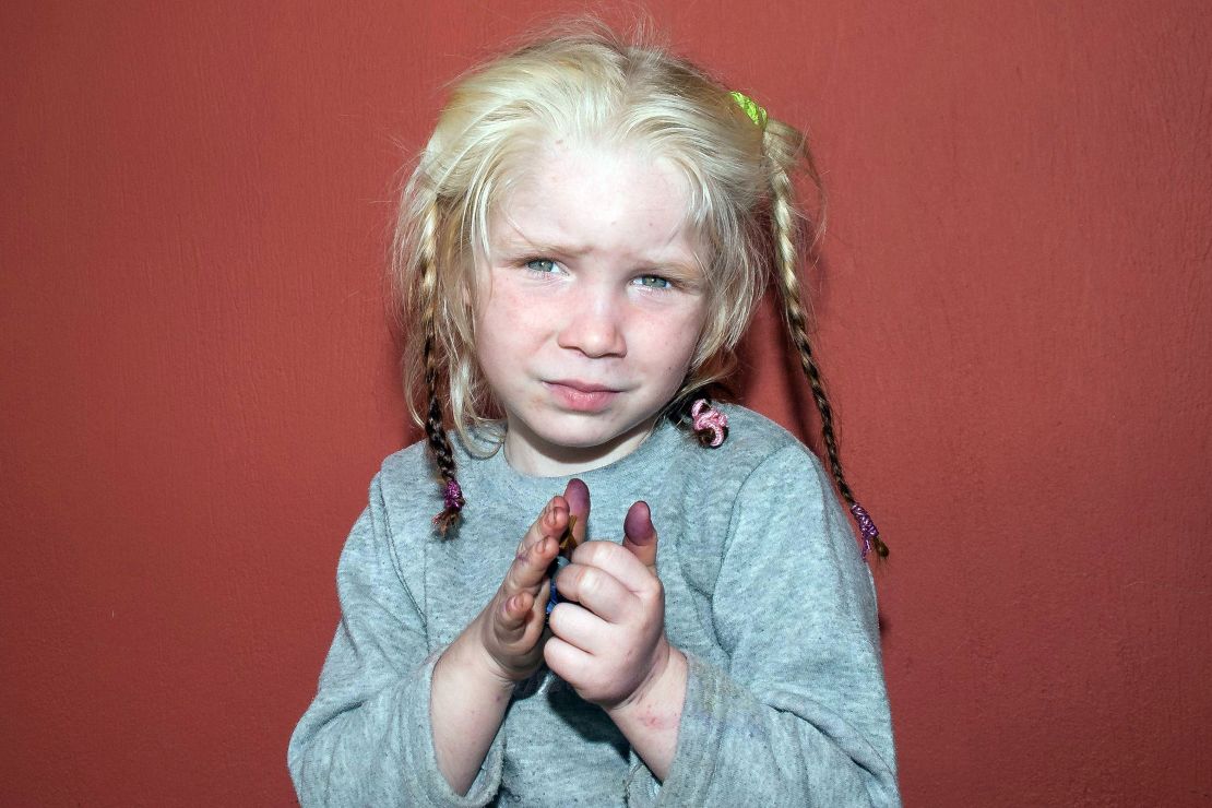 Handout photo released by Greek police shows an unidentified 4-year-old girl who was found on October 17, 2013 near Farsala in central Greece during a crackdown on illegal activities by Roma. 