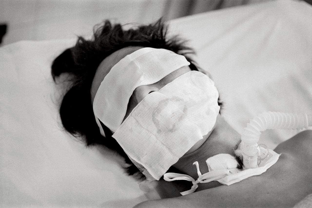 Comatose and on a ventilator, a bird flu patient in Hanoi who was not expected to live made a remarkable recovery, in this haunting photograph by Lynn Johnson.