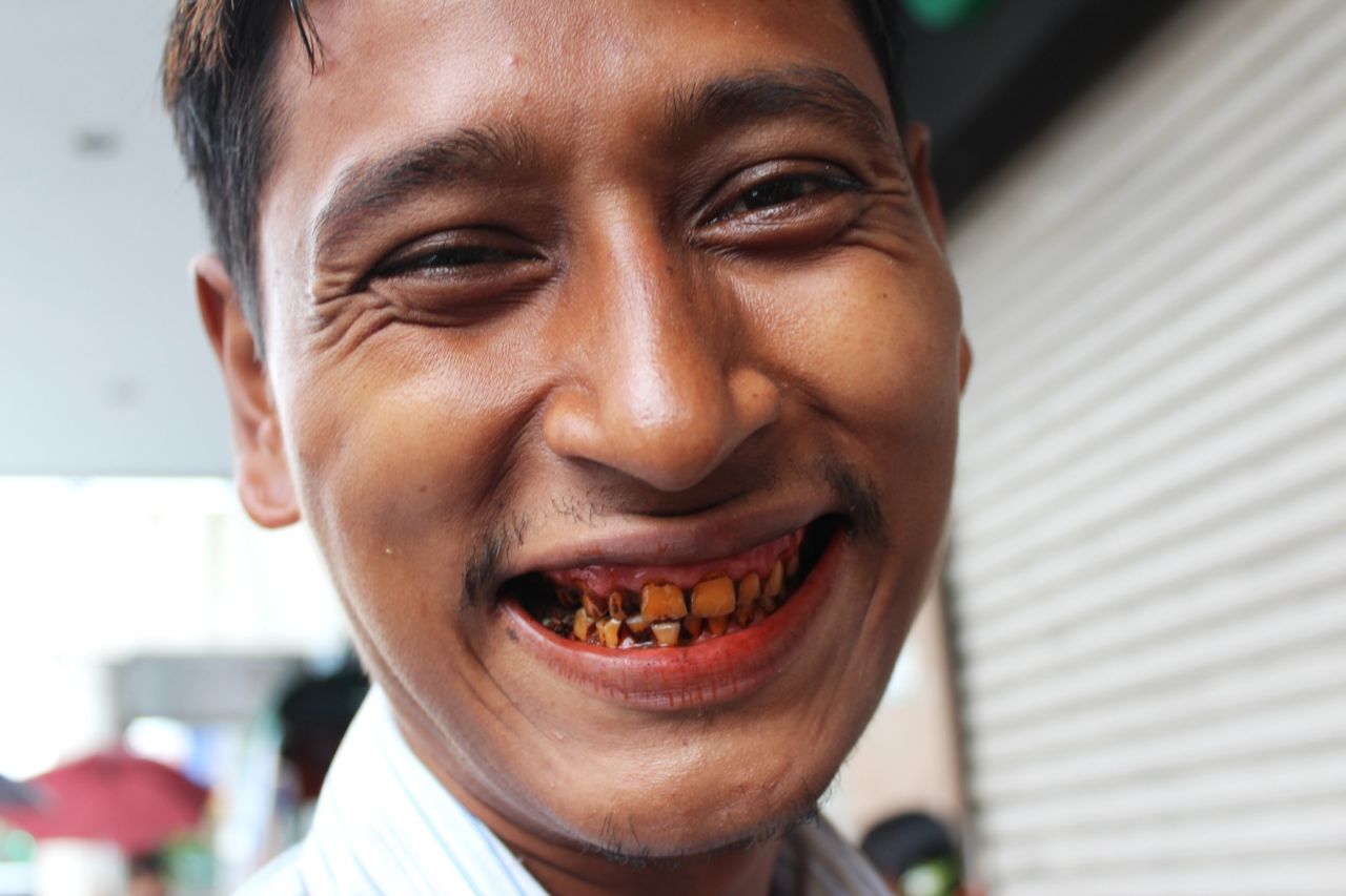 A man shows off his stained teeth, dyed red from years of chewing betel quids, potent parcels of areca nuts, lime and tobacco wrapped in a betel leaf. They give users a buzz when they're chewed but are also known to cause oral cancer.