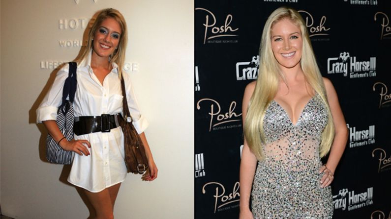 Heidi Montag started with breast augmentation and a nose job in 2007 and eventually<a href="index.php?page=&url=http%3A%2F%2Fwww.cnn.com%2F2010%2FSHOWBIZ%2FTV%2F01%2F13%2Fheidi.montag.plastic.surgery%2F"> opted for 10 surgeries</a> in order to change her look -- leaving her unrecognizable to many of her fans from the reality show "The Hills."  