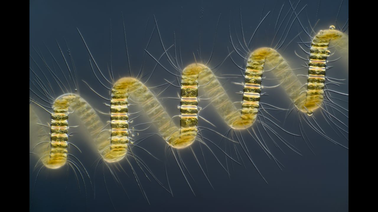 Mr. Wim van Egmond; Micropolitan Museum; Chaetoceros debilis (marine diatom), a colonial plankton organism