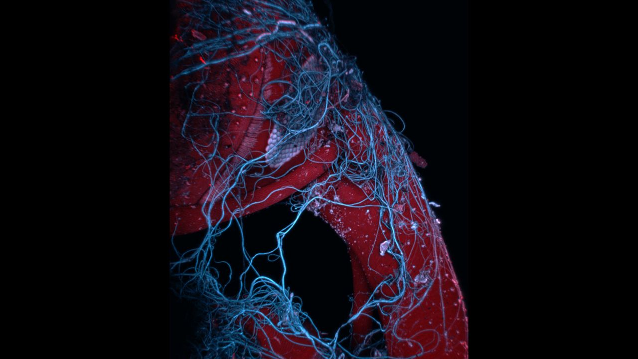 Mr. Mark A. Sanders; University Imaging Centers, University of Minnesota; Insect wrapped in spider web