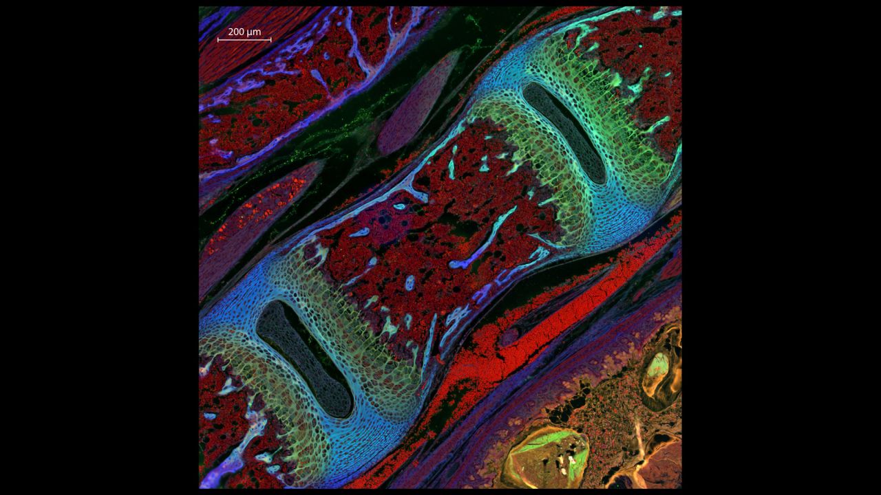 Dr. Michael Paul Nelson and Samantha Smith; Department of Pathology/Neuropathology, University of Alabama at Birmingham; Mouse vertebra section