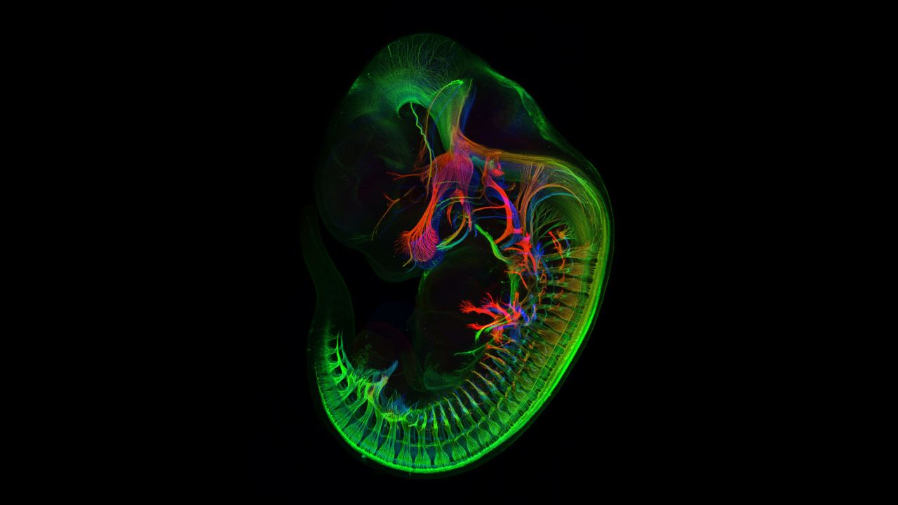Mr. Zhong Hua; Department of Molecular Biology & Genetics, Johns Hopkins University School of Medicine; Peripheral nerves in E11.5 mouse embryo