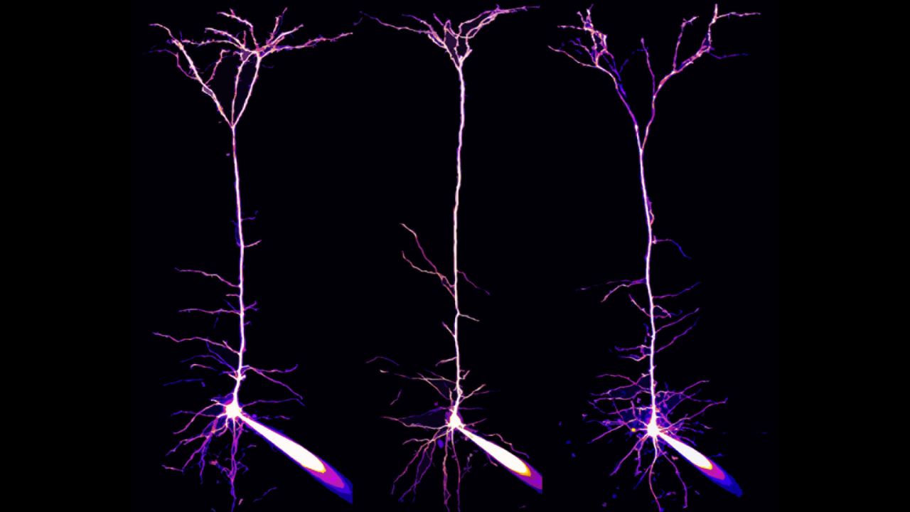 Dr. Alexandre William Moreau; Institute of Neurology, University College London; Pyramidal neurons and their dendrites visualized in the visual cortex of a mouse brain