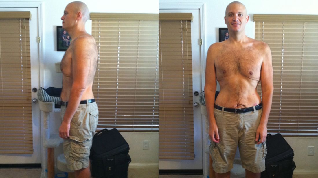 In 14 months, Shack dropped 265 pounds. In September 2010, he weighed 235 pounds.