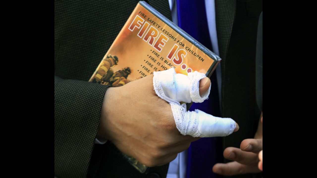Booker's bandaged right hand holds a children's fire safety video that was given to him by a well-wisher in April 2012. Booker made national headlines then for rescuing a next-door neighbor from a fire.