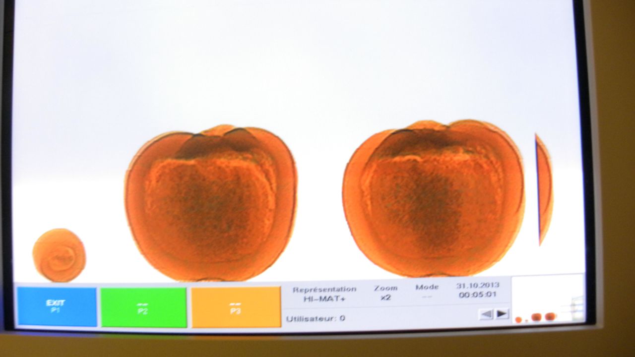 That's an x-ray of three cocaine-filled pumpkins, according to Canadian officials. 
