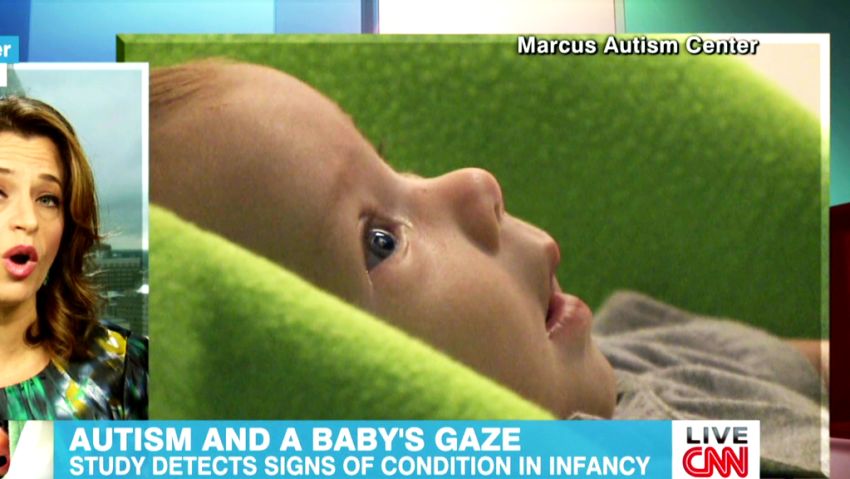 Autism and babies Cohen Newday _00013422.jpg