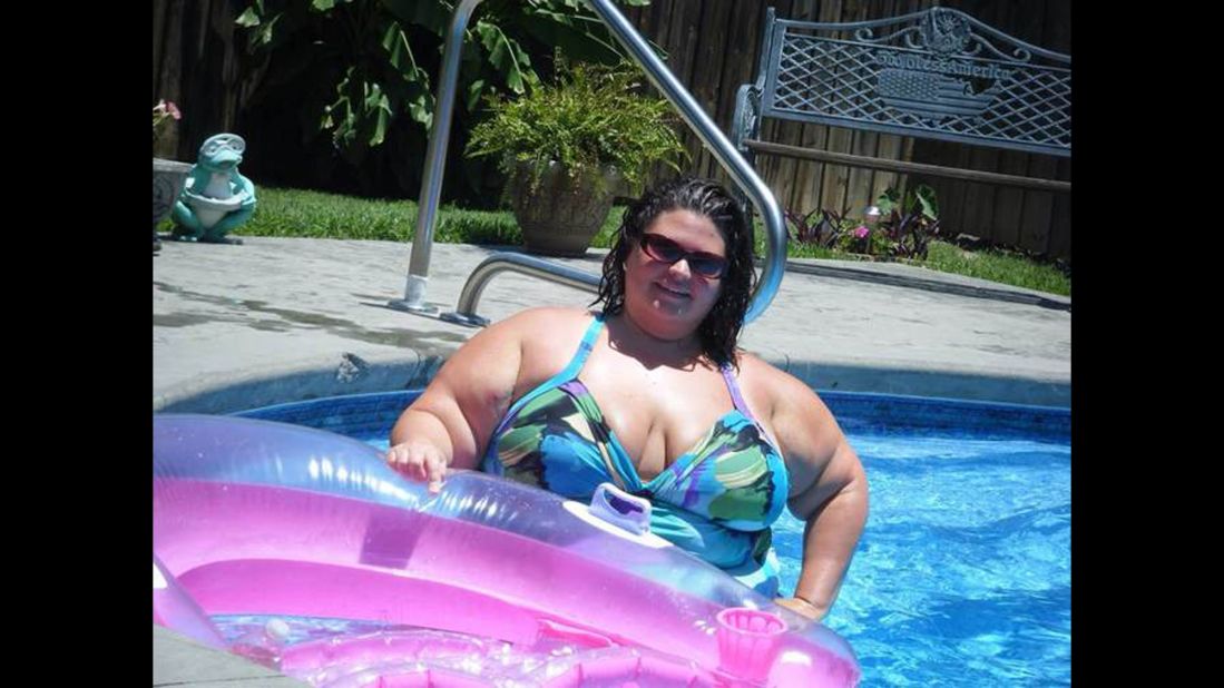 During her honeymoon in Florida, Privitera wasn't able to go to the beach for long periods because she was so uncomfortable. She was at her peak weight of 381 pounds and remembers crying in the car on the way home. 
