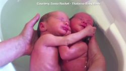 tsr pkg moos cuddling twins bath time_00011030.jpg