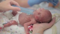 vo dads time lapse of preemie baby viral video _00012009.jpg