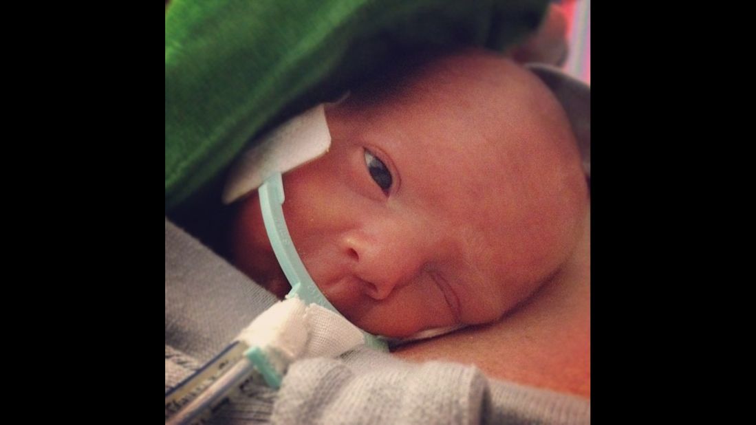 Born 3.5 months early, Ward Miles Miller weighed only 1 pound, 13 ounces.  