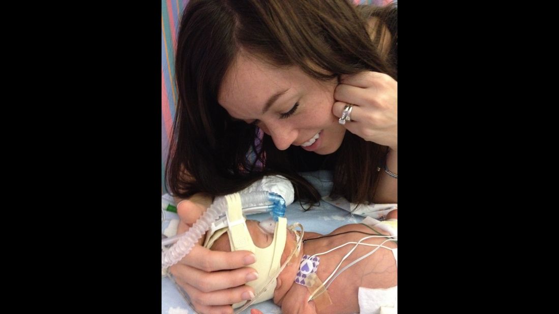 Lyndsey Miller looks adoringly at her son in the NICU while she cradles his tiny head surrounded by tubes and wires. 