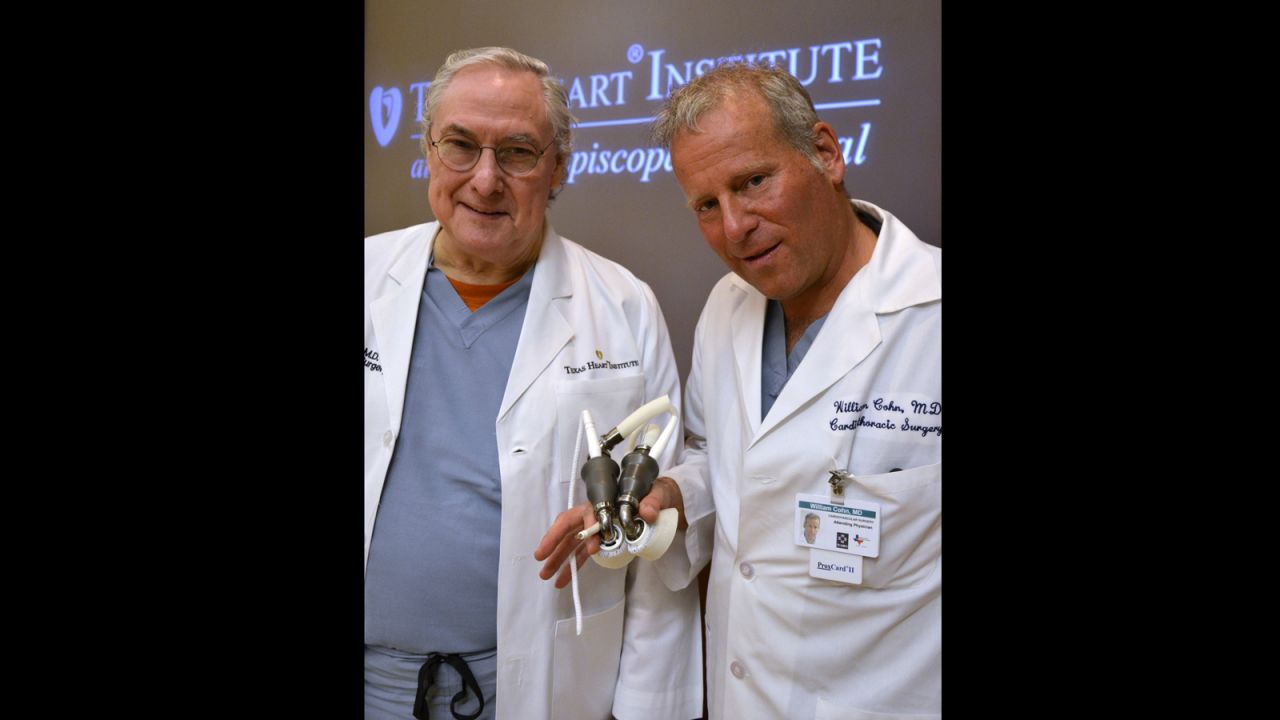 A principios de 2000, el doctor O. H. "Bud" Frazier —izquierda— y el Dr. Billy Cohn comenzaron a combinar dos LVAD, o dispositivos de asistencia ventricular izquierda, para crear un corazón artificial. Evaluaron el dispositivo en alrededor de 70 terneras, de las cuales la mayoría sobrevivió durante los estudios de 90 días de duración. 