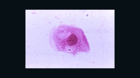 The bacterium Neisseria meningitidis is shown. It spreads when people in close contact share saliva or spit.
