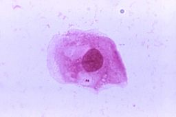 The bacterium Neisseria meningitidis is shown. It spreads when people in close contact share saliva or spit.