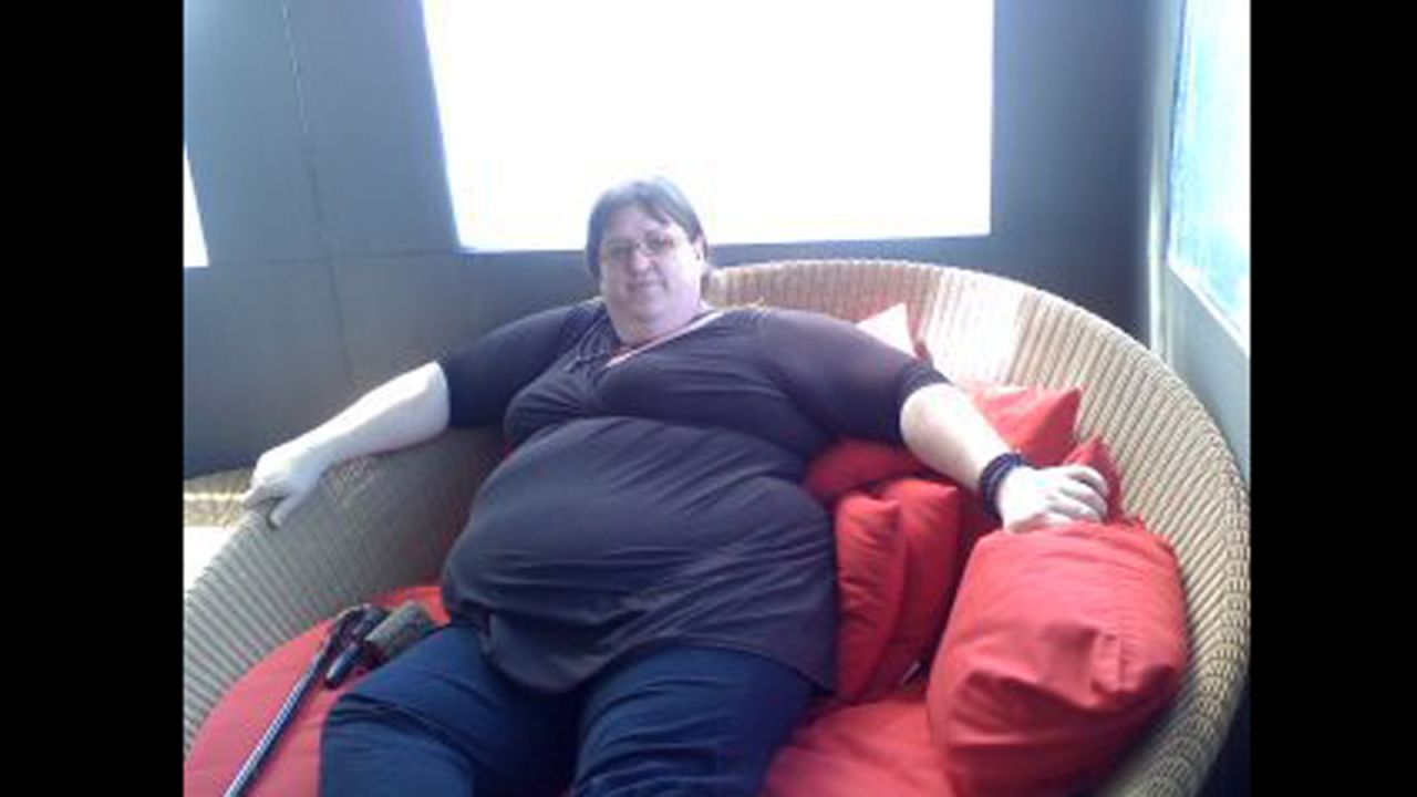 After a spinal injury left her partially paralyzed below the waist, Mia Vayner ballooned to 540 pounds. She wore a size 36 dress.