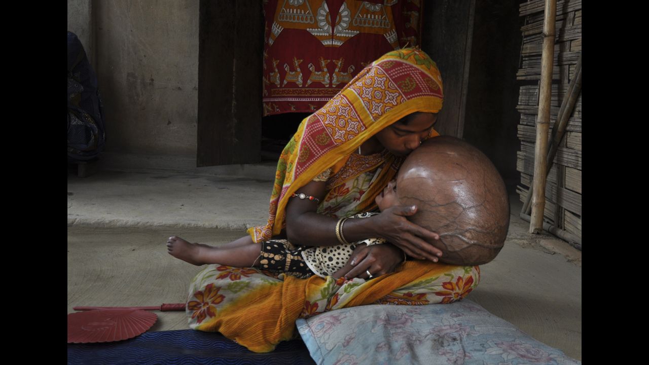 <strong>April 13:</strong> Indian villager Fatima Begum kisses the head of her 18-month-old daughter, Roona, at their hut in Jirania, India. Roona suffers from hydrocephalus, a disorder causing cerebral fluid to build up in the brain. Doctors had given her just a few months to live, but she recently underwent surgery to improve her condition.
