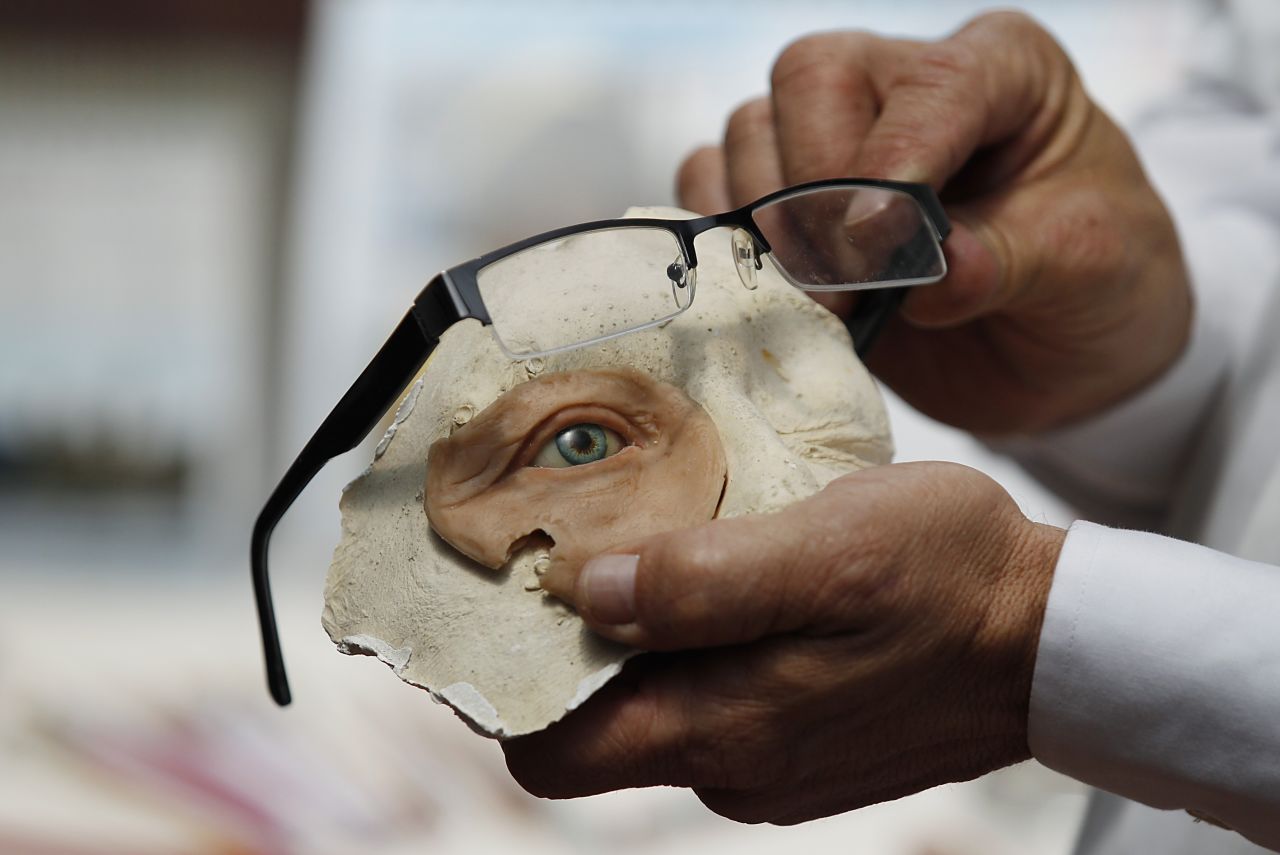<strong>February 5:</strong> Anaplastologist Hernan Baron displays a prosthetic eye at his studio in Bogota, Colombia.