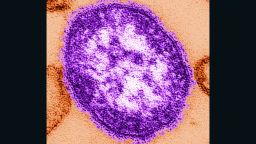 A single virus particle of measles virus