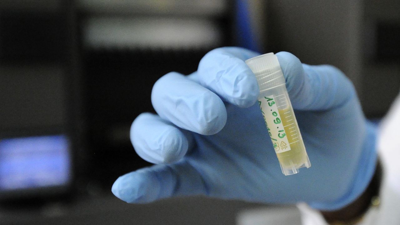 A laboratory employee holds a sample from a person living with HIV in a laboratory at the AIDS Research Center of the Treichville hospital in Abidjan on on September 13, 2013, after the launch in the Ivorian capital of the Unitaid-funded project OPP-ERA, which aims at improving HIV monitoring through more affordable access to HIV viral load testing (VLT) for HIV patients and early infant diagnosis. Ivory Coast is the first country in Africa to join the two-year project,  implemented by a consortium of French partners. AFP PHOTO/ SIA KAMBOU        (Photo credit should read SIA KAMBOU/AFP/Getty Images)