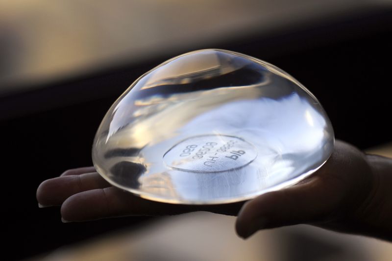 French court orders damages for victims of breast implant scandal