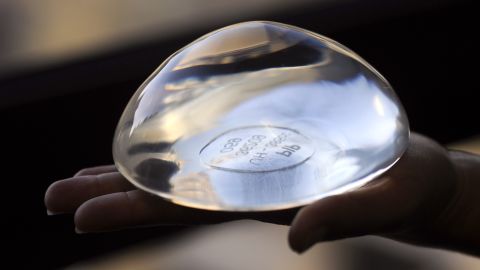 A breast implant produced by Poly Implant Prothese, or PIP, in Marseille, France.