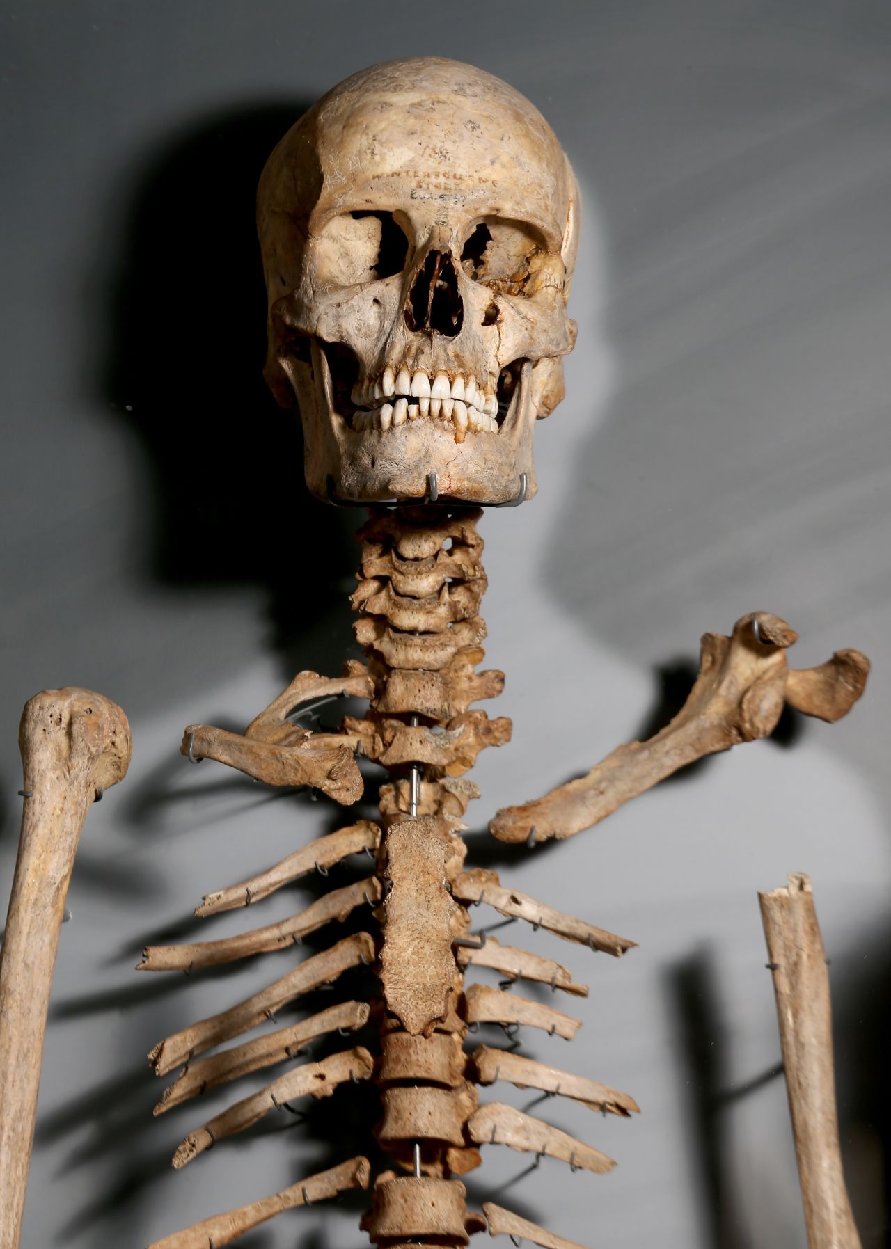 The ancient Briton's skeleton shows his age more clearly.