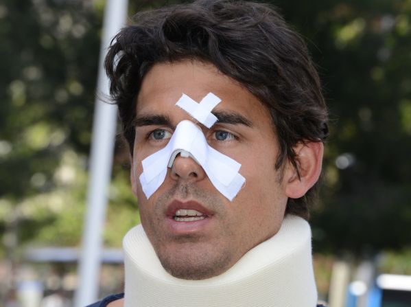 Drouet is pictured here after the assault. In a diary that was later published by an Australian newspaper, Drouet claimed John Tomic punched his son in the face and shot him in the leg with a BB gun. 