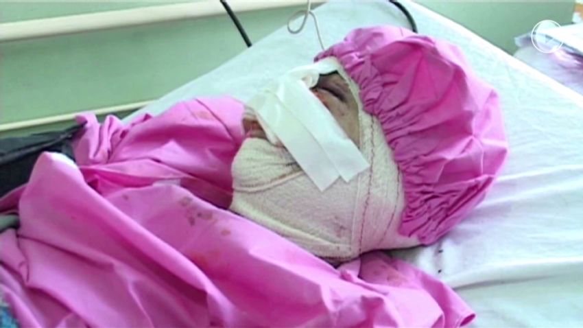 pkg shubert afghan women violence_00013820.jpg
