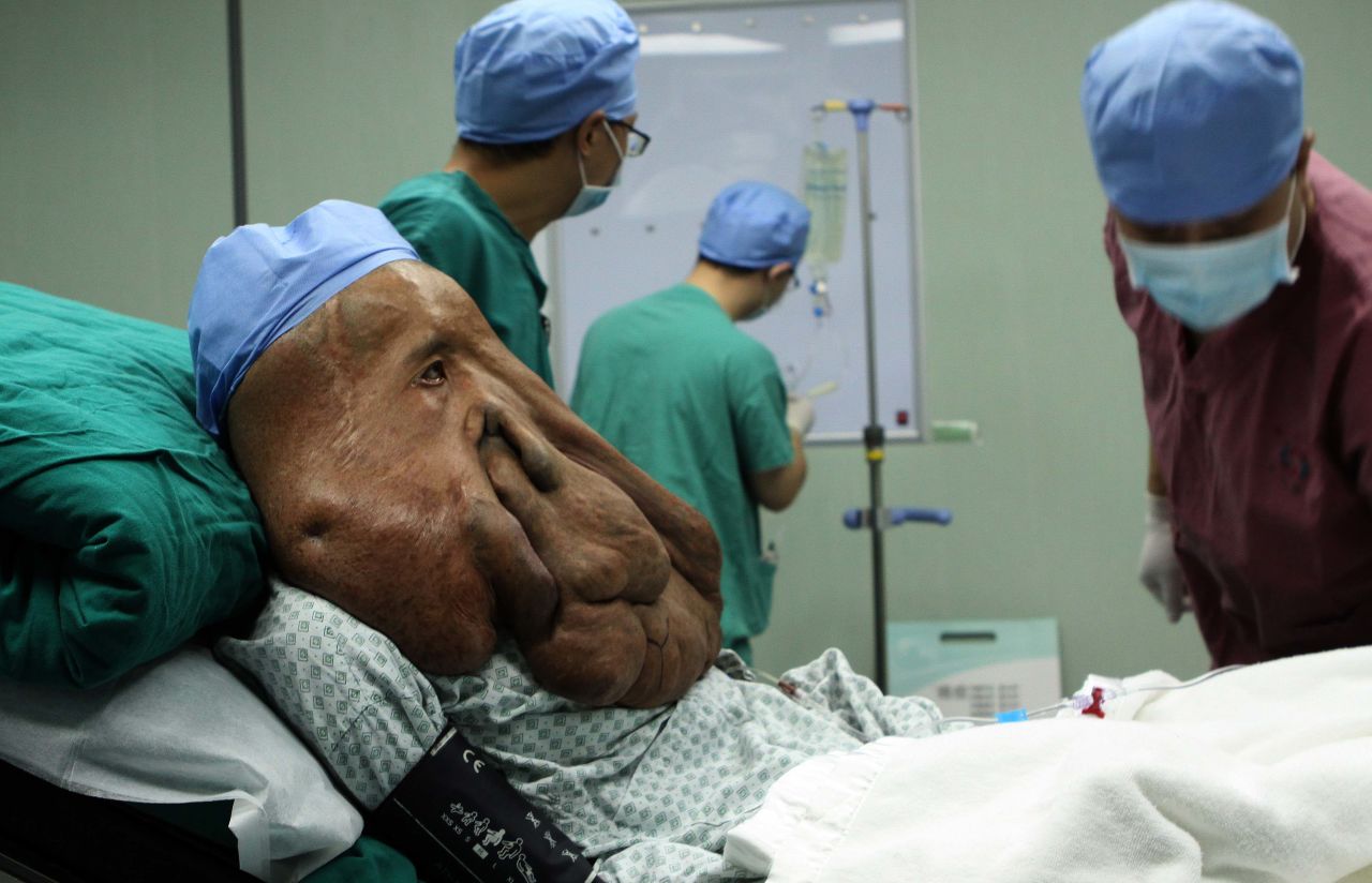 <strong>December 25:</strong> Doctors prepare to operate on Huang Chuncai, a 36-year-old farmer suffering from a rare facial tumor, in Guangzhou, China.