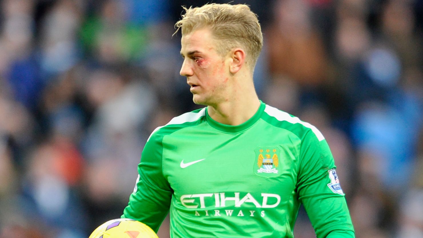 Man City keeper Joe Hart suffered a cut under his eye but stayed in the game and impressed against Crystal Palace. 