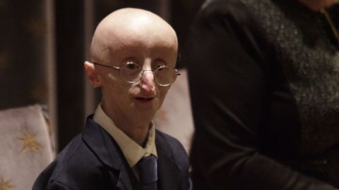  Sam Berns became well-known for being public about his life with progeria, which causes accelerated aging.