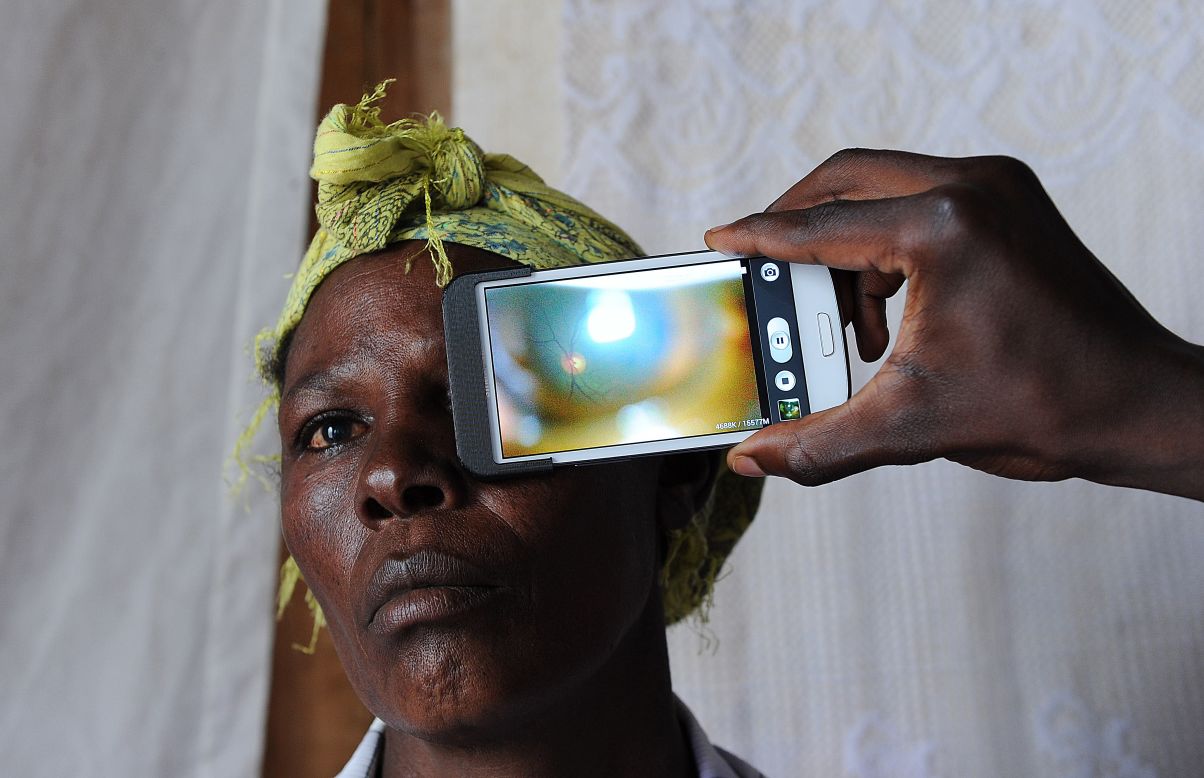 A technician scanning the eye of a woman with a smartphone application in rural Kenya.<br />