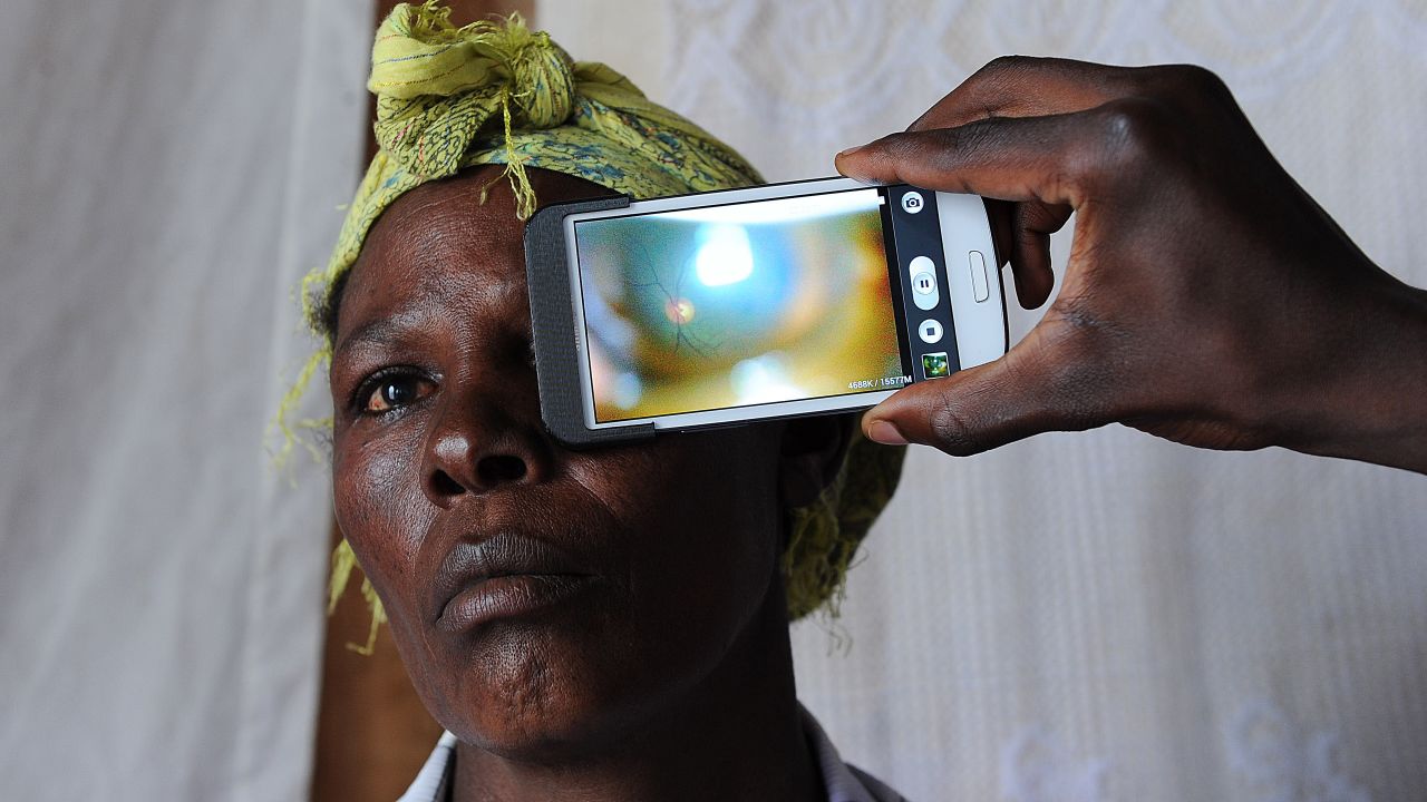 A technician scanning the eye of a woman with a smartphone application in rural Kenya.
