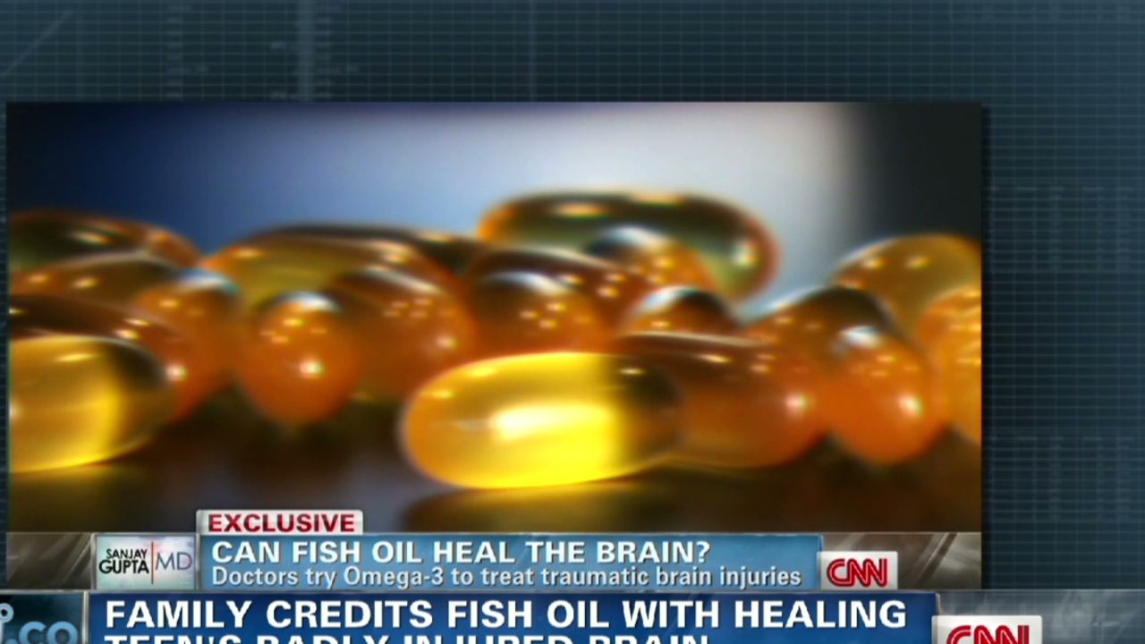 ac gupta omega 3 help for brain injuries_00015918.jpg