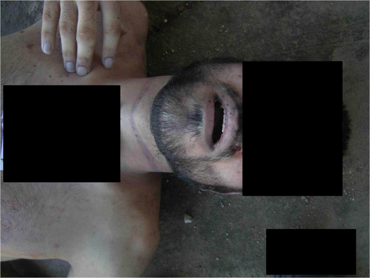 The report alleges that this image shows marks left behind from strangulation.
