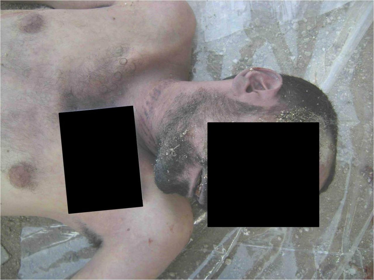More patterned marks allegedly left behind by strangulation.
