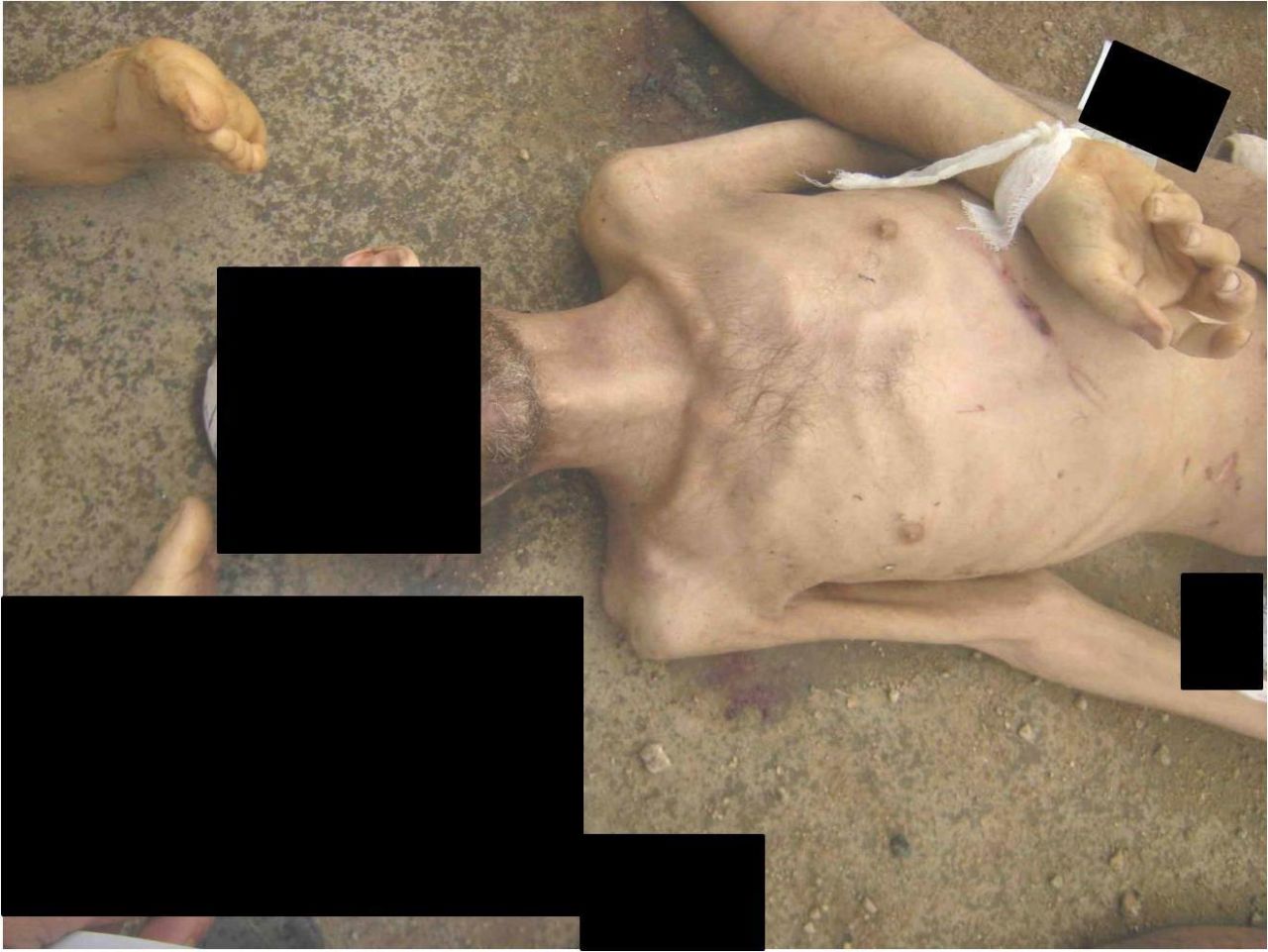 An emaciated man with marks allegedly left behind from beatings.